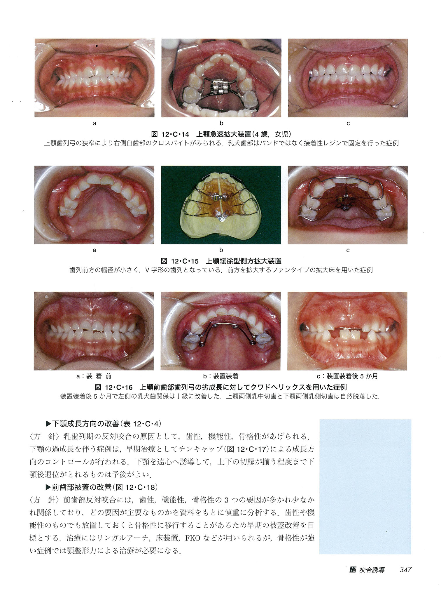 小児の口腔科学 シエン社 | 小児の口腔科学<第3版>